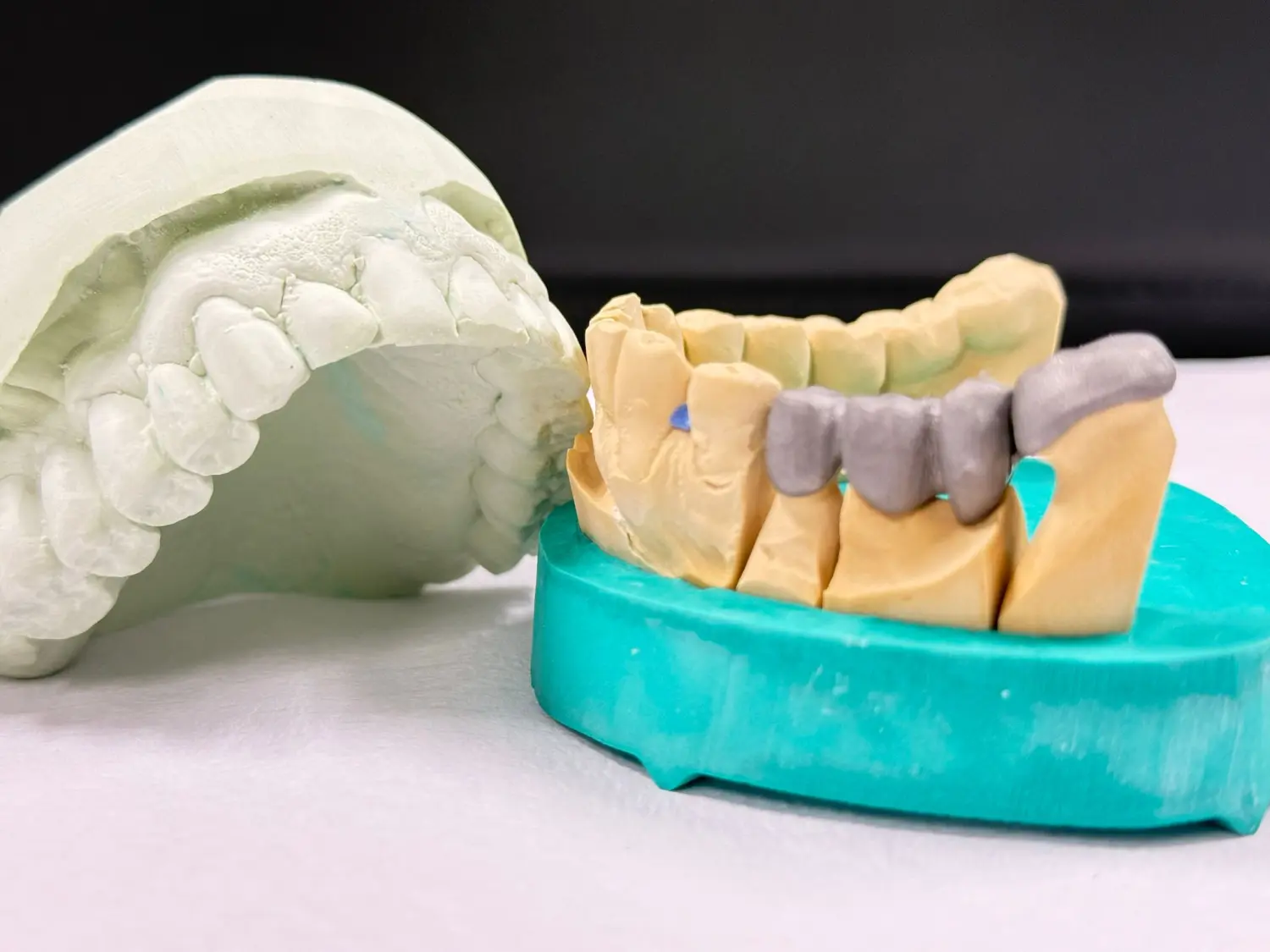 Kruse & Mordhorst Zahntechnik GmbH – Dieses Bild zeigt eine individuell angefertigte Zahnprothese, wahrscheinlich eine Brücke oder eine Hybridprothese, montiert auf einem Steingussmodell zur Zahnrestaurierung.